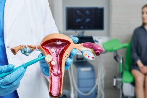 Лечение миомы матки в Израиле