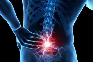 Лечение метастазов в позвоночнике в Израиле