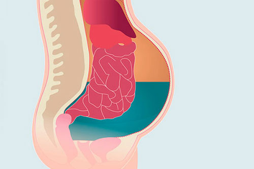 Лечение асцита в Израиле