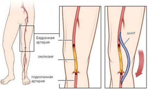 Сосуды головного мозга: симптомы, лечение, сужение