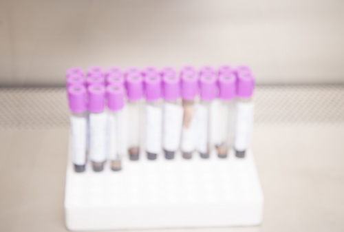 Лечение тромбоцитопении в Израиле