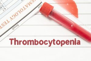 Тромбоцитопения