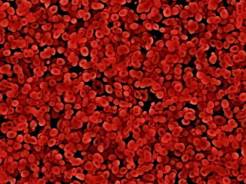 Лечение гепатоза печени в Израиле