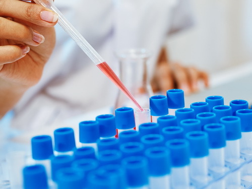 Лечение гепатоза печени в Израиле