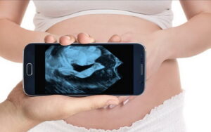 Смартфоны смогут делать УЗИ беременности
