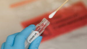 Домашний тест на коронавирус