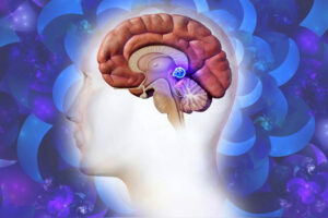 Лечение пинеаломы в Израиле